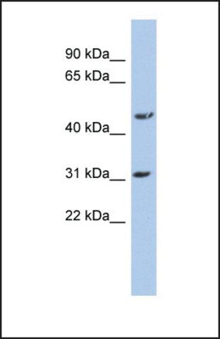 Anti-DBT, (N-terminal) antibody produced in rabbit