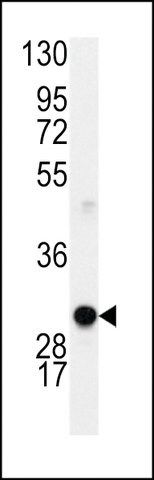 ANTI-CYCLIN D1 (S90) antibody produced in rabbit