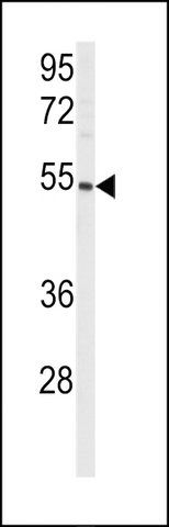 ANTI-CYP8A1(N-TERMINAL) antibody produced in rabbit