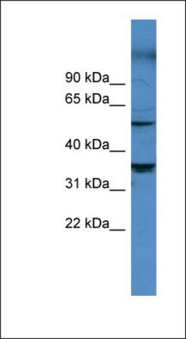 Anti-CYP11B1 antibody produced in rabbit