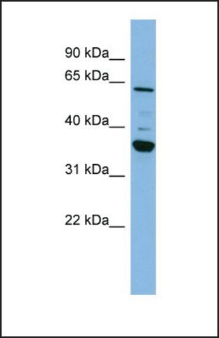 Anti-CYP3A7 antibody produced in rabbit