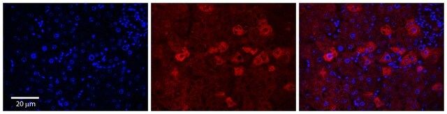 Anti-CYP4F3, (N-terminal) antibody produced in rabbit