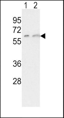 ANTI-CYP7A1 (C-TERM) antibody produced in rabbit