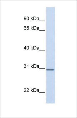 Anti-DCI antibody produced in rabbit