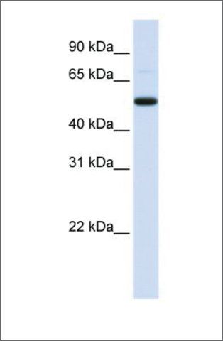 Anti-DCP2 antibody produced in rabbit