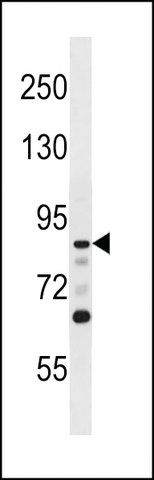 ANTI-DCAMKL1(N-TERMINAL) antibody produced in rabbit