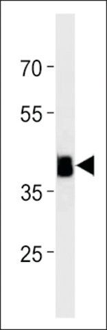 ANTI-DANRE HOXC11A(N-TERMINAL) antibody produced in rabbit