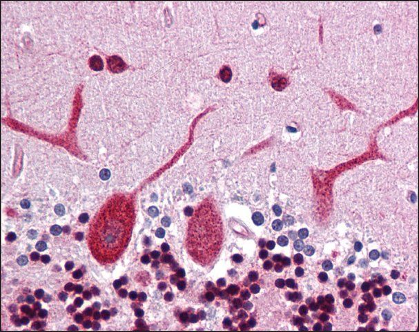 Anti-DCLK3 antibody produced in rabbit