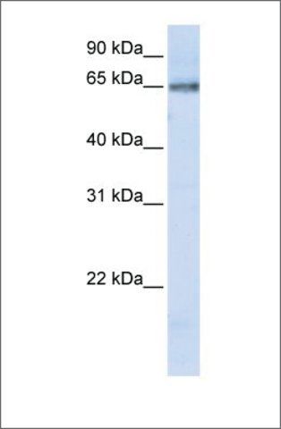 Anti-DCLRE1C (ab1) antibody produced in rabbit