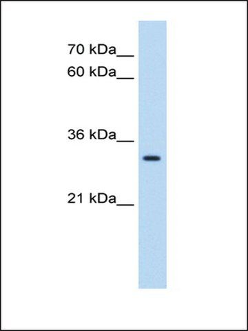 Anti-DBX2 antibody produced in rabbit