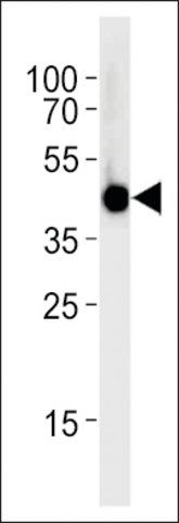 ANTI-DANRE IRF2BP2A (CENTER) antibody produced in rabbit