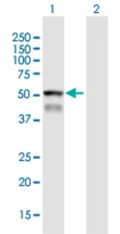 Anti-CYP4F8 antibody produced in mouse