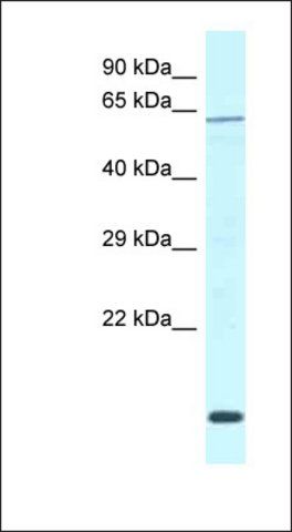 Anti-DCAF11 antibody produced in rabbit