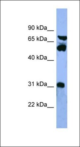 Anti-CYP8B1 antibody produced in rabbit