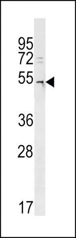 ANTI-DCAF12L2(C-TERMINAL) antibody produced in rabbit