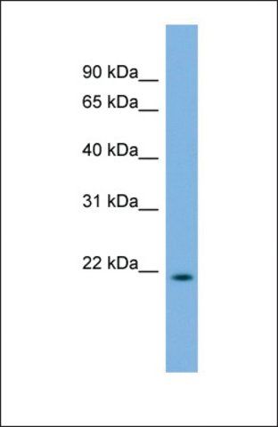 Anti-DCTD antibody produced in rabbit