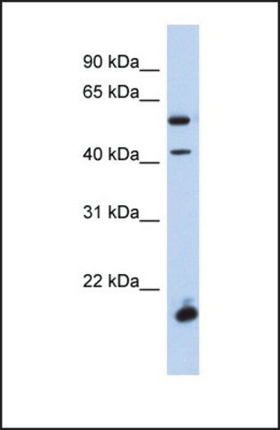 Anti-DBX1 antibody produced in rabbit