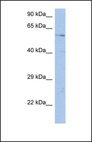 Anti-DCBLD1, (N-terminal) antibody produced in rabbit