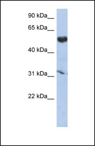 Anti-CYP4X1 antibody produced in rabbit