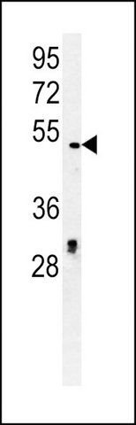 ANTI-DCC1 (C-TERM) antibody produced in rabbit