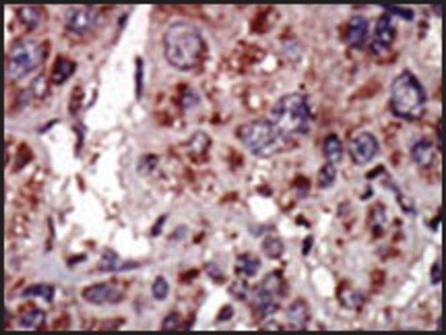 Anti-DGKA (C-term) antibody produced in rabbit