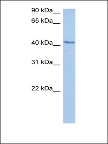 Anti-DCP2 antibody produced in rabbit