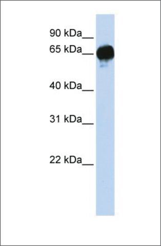 Anti-DGKE antibody produced in rabbit