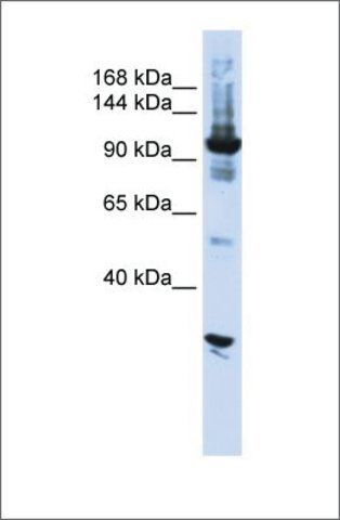 Anti-DIS3 antibody produced in rabbit