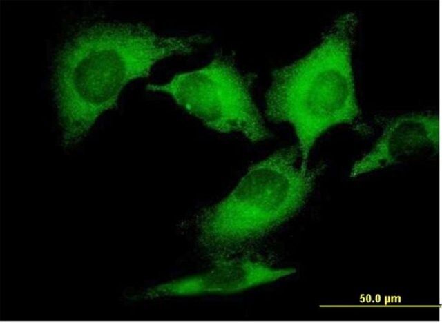 Anti-DCTN2 antibody produced in mouse