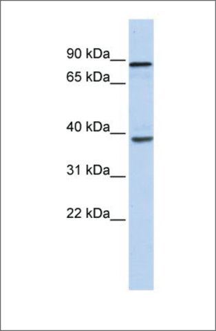 Anti-DHX35 antibody produced in rabbit