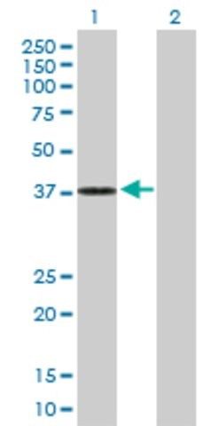 Anti-DHRS7 antibody produced in mouse