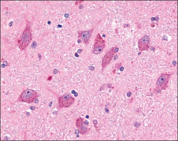 Anti-BAI2 antibody produced in rabbit