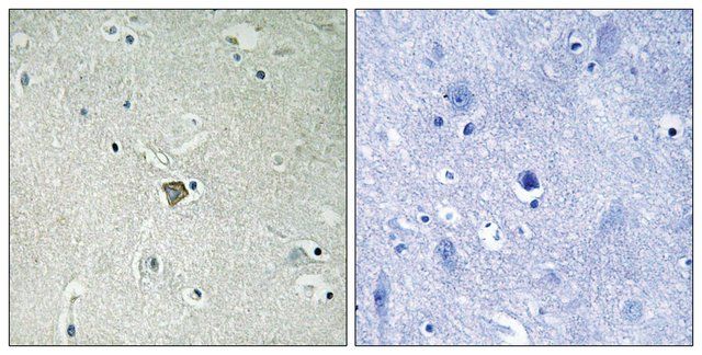 Anti-Bax antibody produced in rabbit