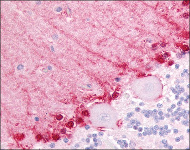 Anti-BAI3 antibody produced in rabbit