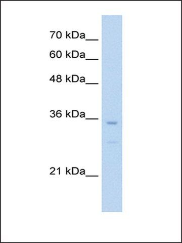 Anti-BAPX1 antibody produced in rabbit