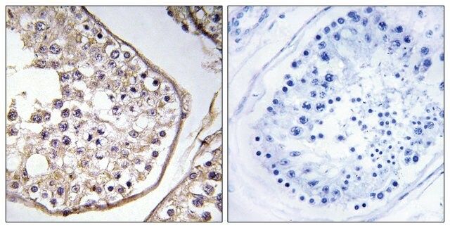 Anti-BAGE3 antibody produced in rabbit