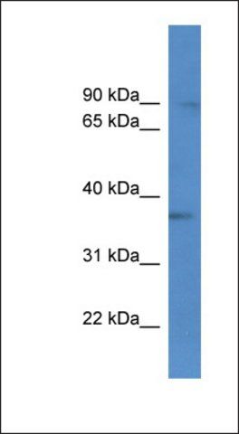 Anti-BRMS1L antibody produced in rabbit