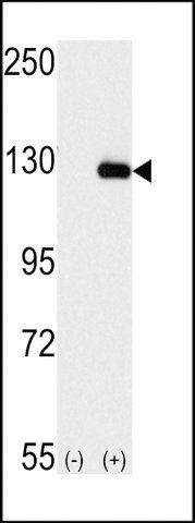 ANTI-BUBR1 (BUB1B)(N-TERMINAL) antibody produced in rabbit