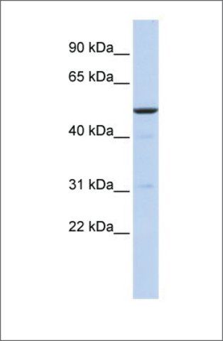 Anti-BTBD3 antibody produced in rabbit