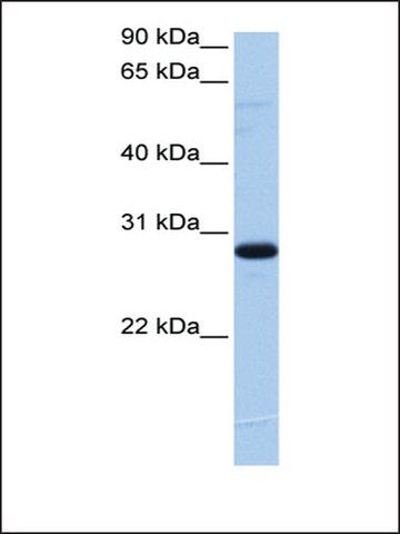 Anti-C1ORF83 antibody produced in rabbit