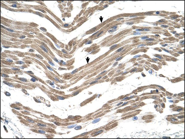 Anti-C1QB antibody produced in rabbit