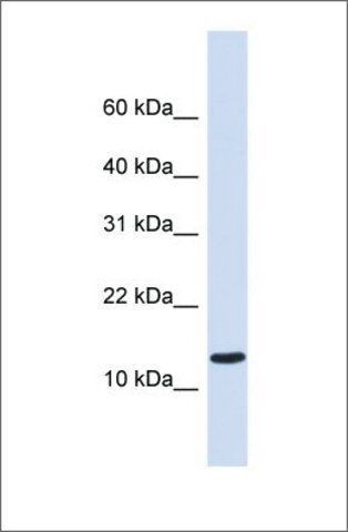 Anti-C1ORF95 antibody produced in rabbit