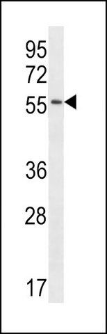 ANTI-C1RL (CENTER) antibody produced in rabbit