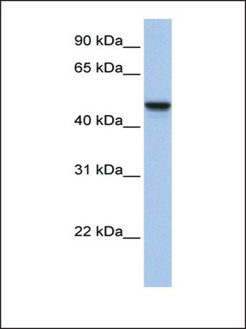 Anti-C20ORF3 (AB1) antibody produced in rabbit