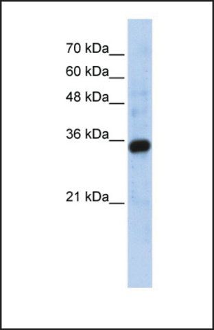 Anti-C1QTNF4 antibody produced in rabbit