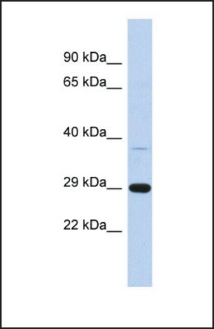 Anti-C1ORF74, (N-terminal) antibody produced in rabbit