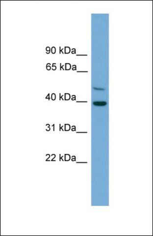 Anti-C21ORF58, (N-terminal) antibody produced in rabbit