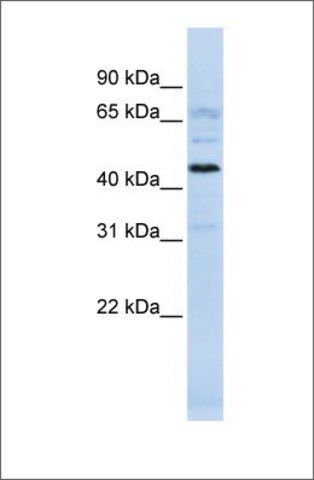 Anti-C22ORF9 antibody produced in rabbit