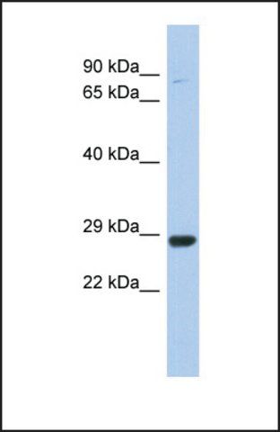 Anti-C21orf91 antibody produced in rabbit