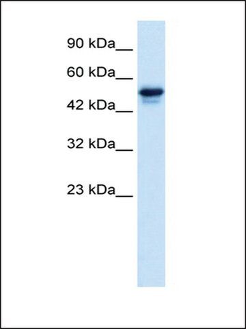 Anti-C21ORF18 antibody produced in rabbit